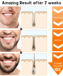 NESLEMY™ PremiumLocks Biotin Hair & Beard Growth Spray