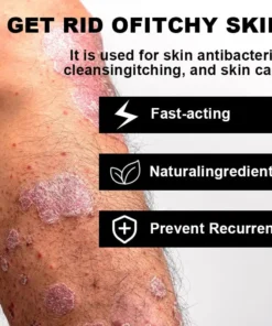 NESLEMY™ Psoriasis Cure Cream
