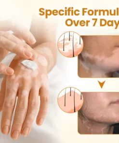 NESLEMY™ VitiClear Pro Bee Venom Cream