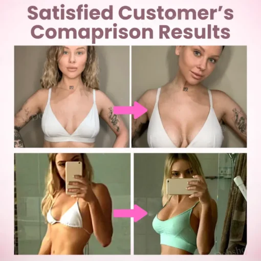 NESLEMY™Breast Enhancement Nano Patch
