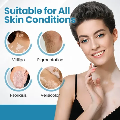 Neslemy™ DermaBeam Vitiligo Therapy Device