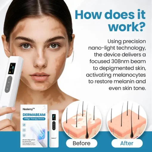 Neslemy™ DermaBeam Vitiligo Therapy Device