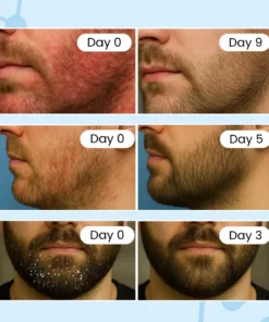 NESLEMY™ Beard Relief Balm