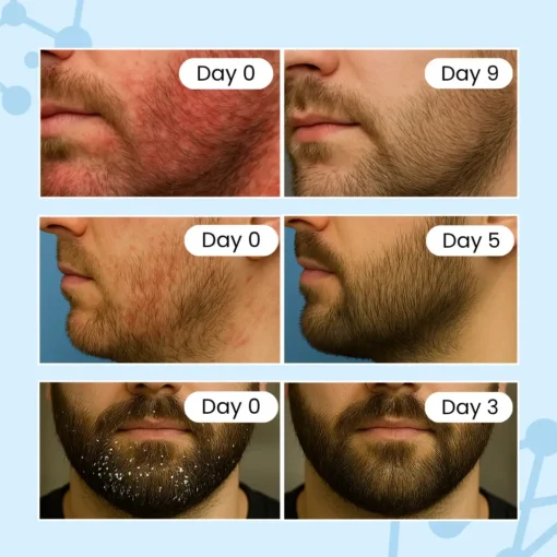 NESLEMY™ Beard Relief Balm