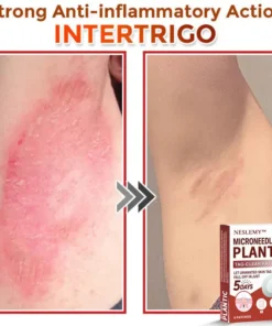 NESLEMY® MicroNeedle Plantic Tag-Clear Patch