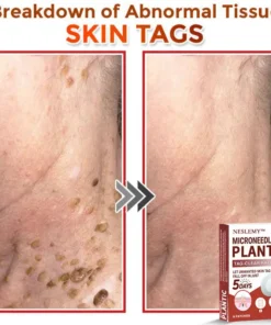 NESLEMY® MicroNeedle Plantic Tag-Clear Patch