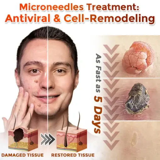 NESLEMY® MicroNeedle Plantic Tag-Clear Patch