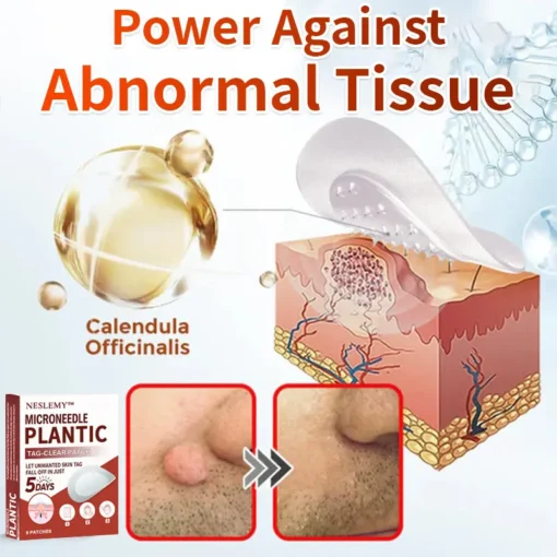 NESLEMY® MicroNeedle Plantic Tag-Clear Patch