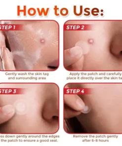 NESLEMY® MicroNeedle Plantic Tag-Clear Patch