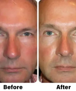 NESLEMY™ Nano Vision Repair Eye Serum