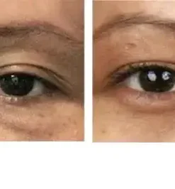 NESLEMY™ Nano Vision Repair Eye Serum