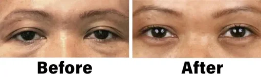 NESLEMY™ Nano Vision Repair Eye Serum