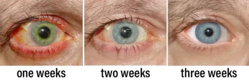 NESLEMY™ Nano Vision Repair Eye Serum