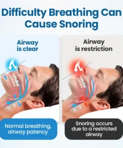 NESLEMY™ SnoreLess Nasal Breather