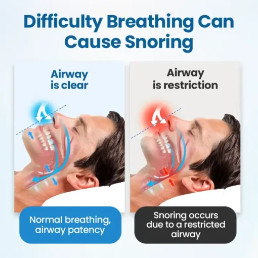 NESLEMY™ SnoreLess Nasal Breather