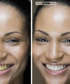 NESLEMY™Coconut Whitening Strips