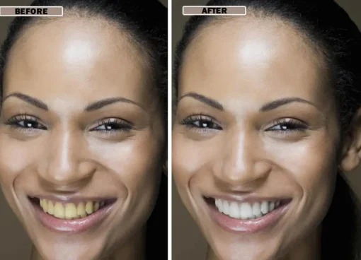 NESLEMY™Coconut Whitening Strips