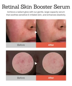 NESLEMY™Retinal Skin Booster Serum