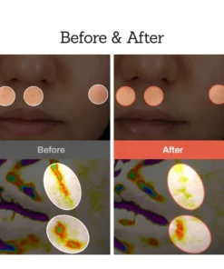 NESLEMY™Retinal Skin Booster Serum