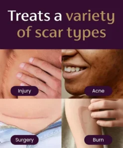 NESLEMY™ Advanced Scar Gel