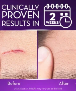 NESLEMY™ Advanced Scar Gel