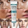 NESLEMY™ Blemish Removing Beauty Cream