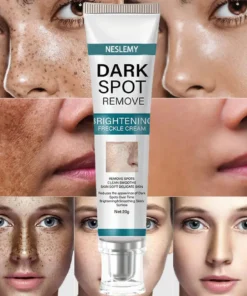 NESLEMY™ Blemish Removing Beauty Cream
