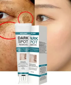 NESLEMY™ Blemish Removing Beauty Cream