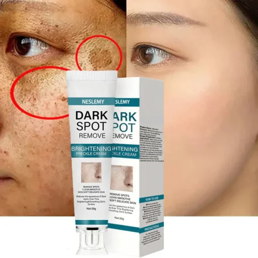 NESLEMY™ Blemish Removing Beauty Cream