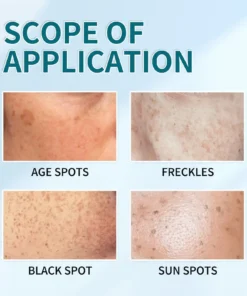 NESLEMY™ Blemish Removing Beauty Cream