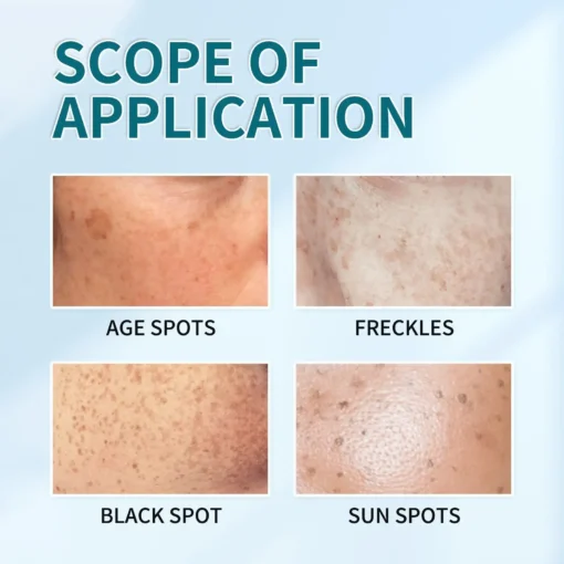 NESLEMY™ Blemish Removing Beauty Cream