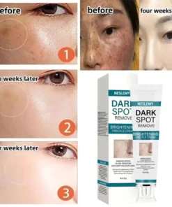 NESLEMY™ Blemish Removing Beauty Cream