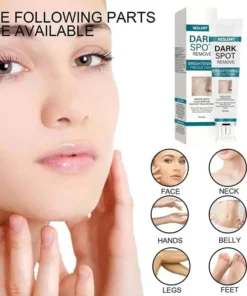 NESLEMY™ Blemish Removing Beauty Cream