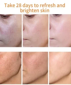 NESLEMY™ Blemish Removing Beauty Cream