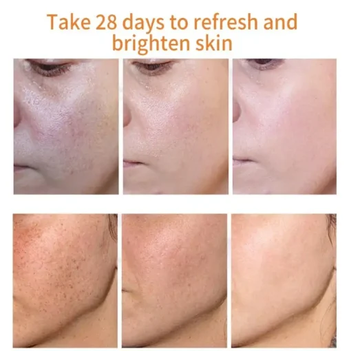 NESLEMY™ Blemish Removing Beauty Cream