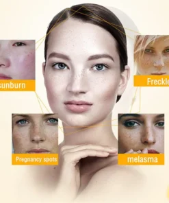 NESLEMY™ Blemish Removing Beauty Cream
