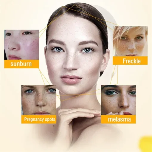 NESLEMY™ Blemish Removing Beauty Cream