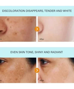 NESLEMY™ Blemish Removing Beauty Cream