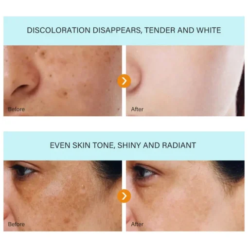 NESLEMY™ Blemish Removing Beauty Cream