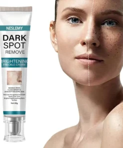 NESLEMY™ Blemish Removing Beauty Cream