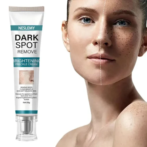 NESLEMY™ Blemish Removing Beauty Cream