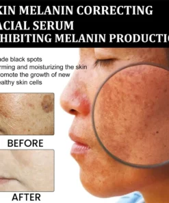 NESLEMY™ Dark Spot Corrector Serum