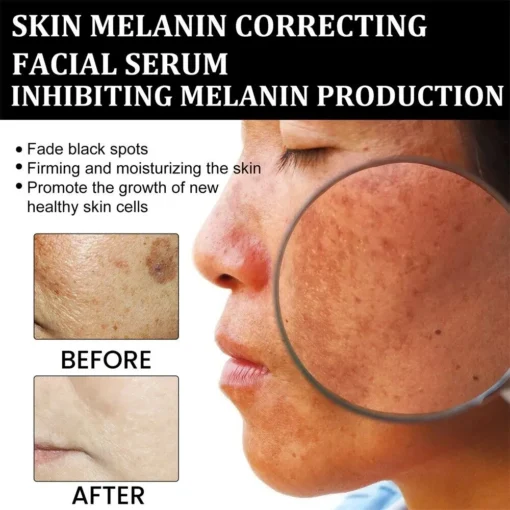 NESLEMY™ Dark Spot Corrector Serum