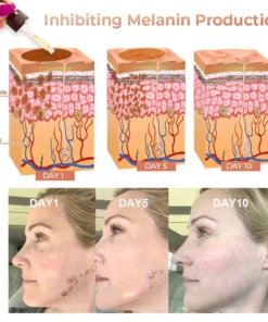 NESLEMY™ Dark Spot Corrector Serum