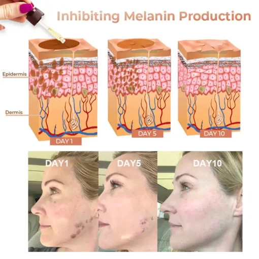 NESLEMY™ Dark Spot Corrector Serum