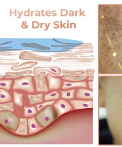 NESLEMY™ Dark Spot Corrector Serum