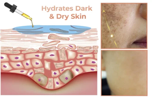 NESLEMY™ Dark Spot Corrector Serum