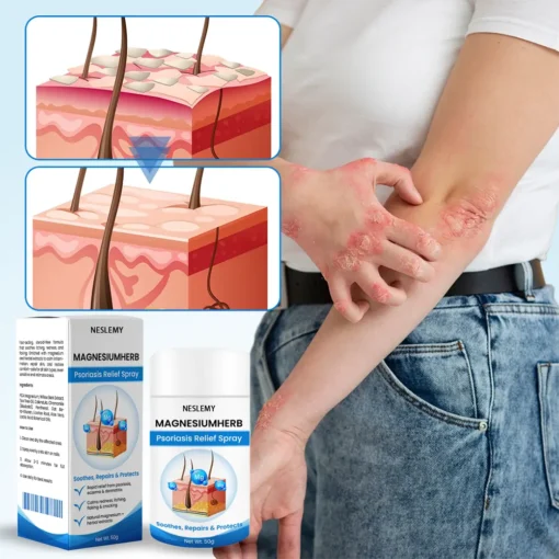 NESLEMY® MagnesiumHerb Psoriasis Relief Cream