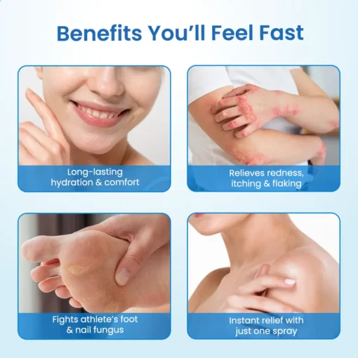 NESLEMY® MagnesiumHerb Psoriasis Relief Cream