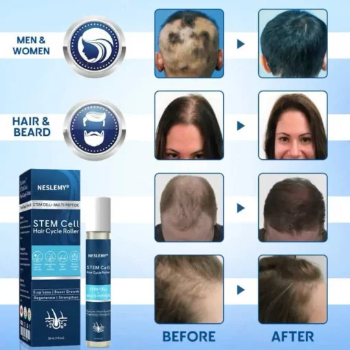 NESLEMY® Stem Cell Hair Roller